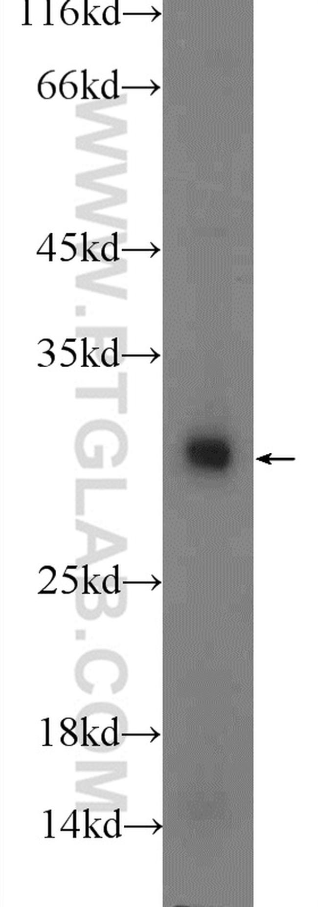 TWIST1 Antibody in Western Blot (WB)