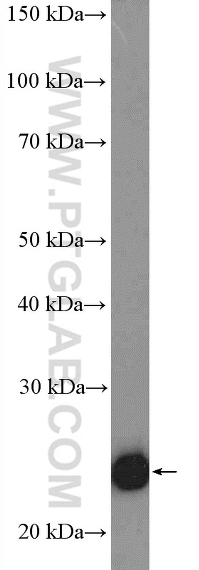 TWIST1 Antibody in Western Blot (WB)