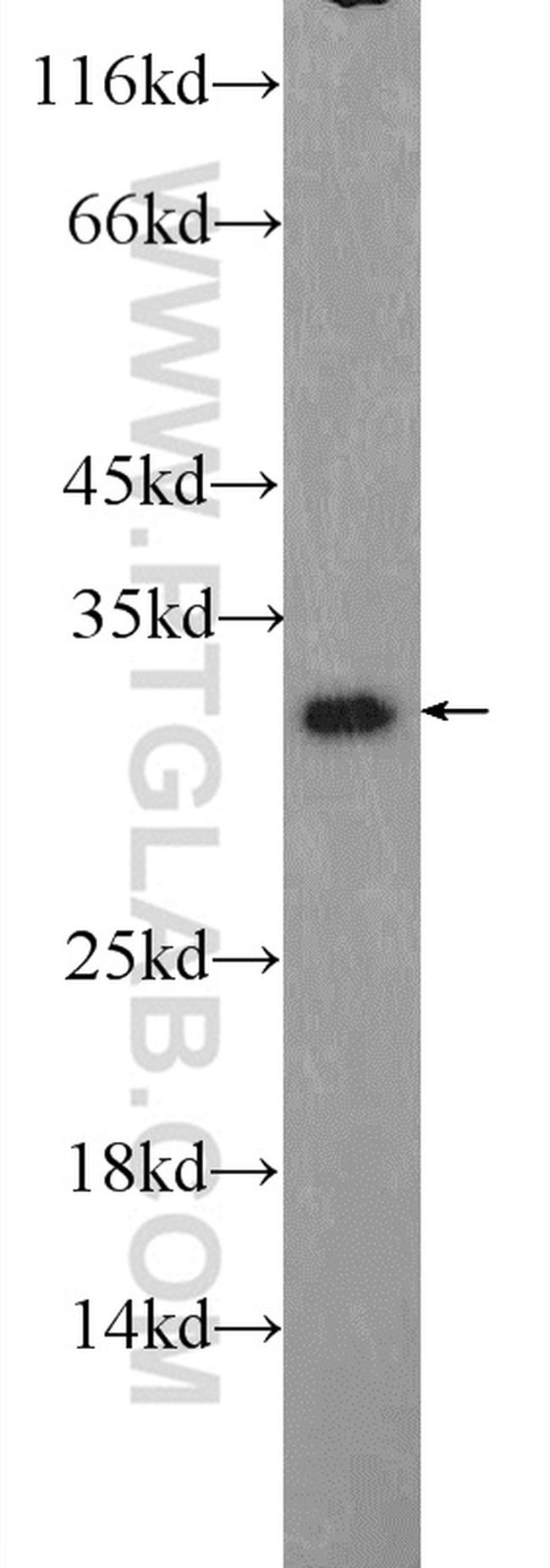 TWIST1 Antibody in Western Blot (WB)