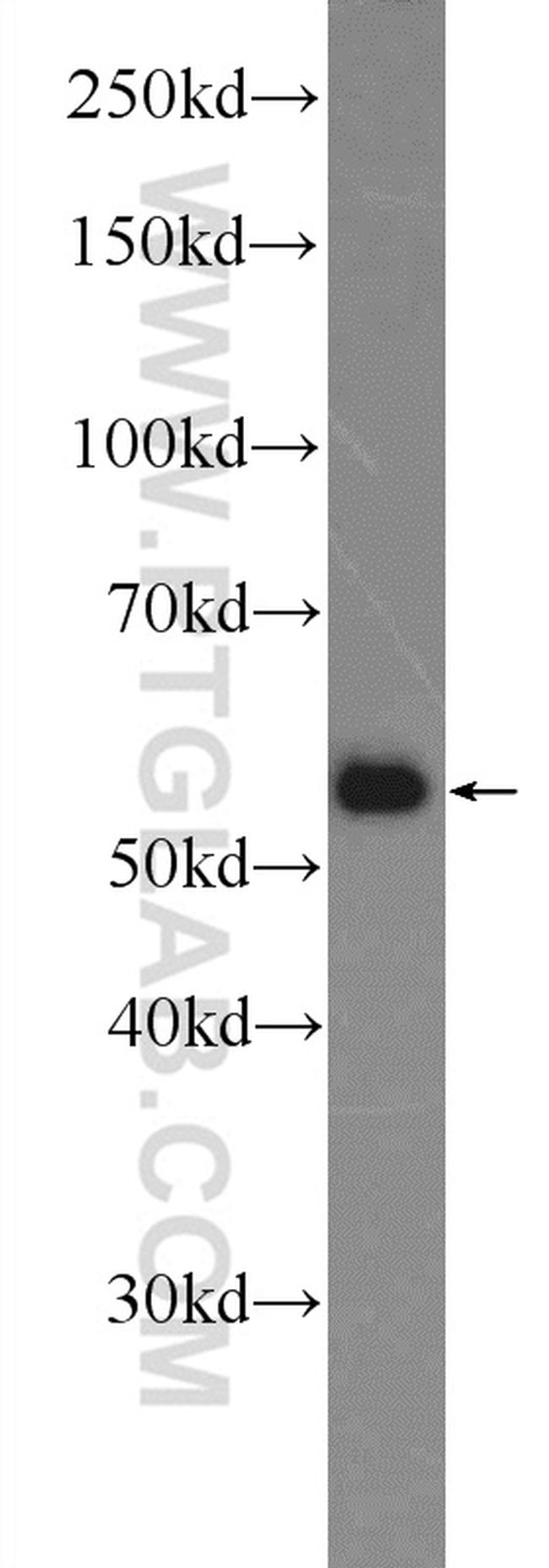 SAAL1 Antibody in Western Blot (WB)