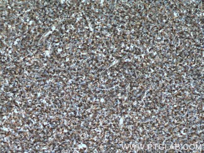 STK10 Antibody in Immunohistochemistry (Paraffin) (IHC (P))