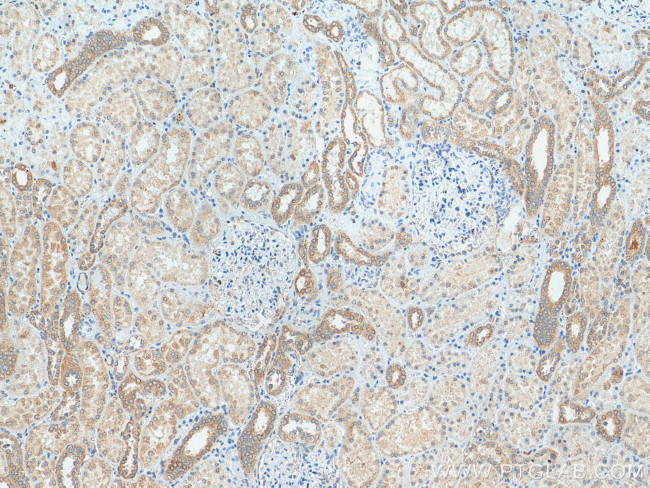 MXRA5 Antibody in Immunohistochemistry (Paraffin) (IHC (P))