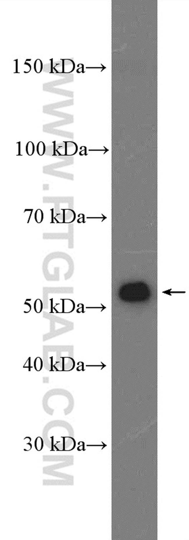 ACSF3 Antibody in Western Blot (WB)