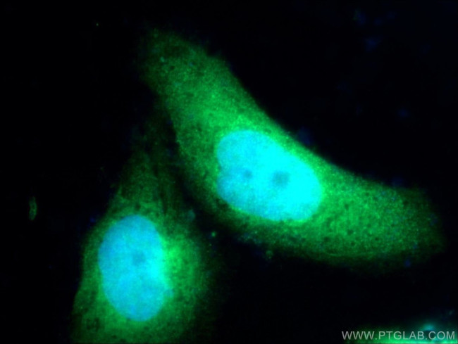 ZNF215 Antibody in Immunocytochemistry (ICC/IF)