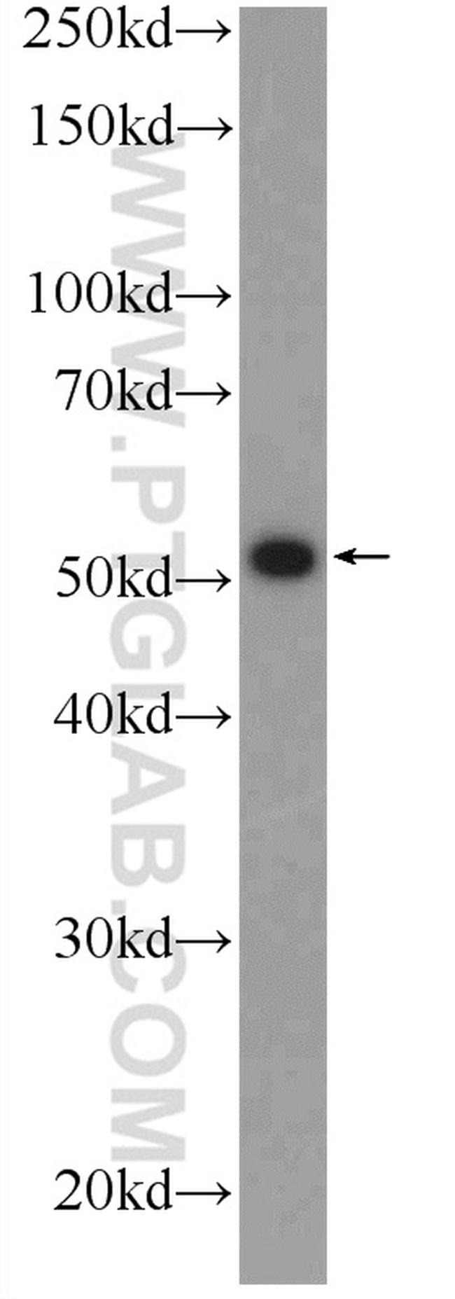 ZNF215 Antibody in Western Blot (WB)