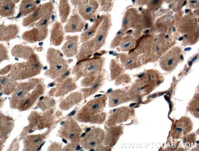 TMEM102 Antibody in Immunohistochemistry (Paraffin) (IHC (P))