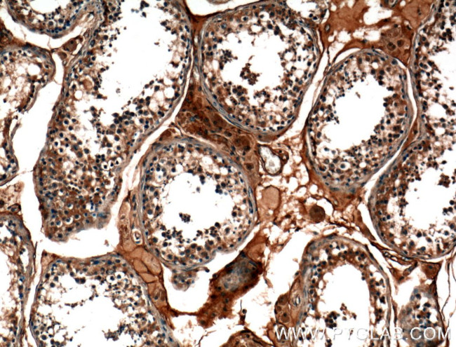 TMEM102 Antibody in Immunohistochemistry (Paraffin) (IHC (P))