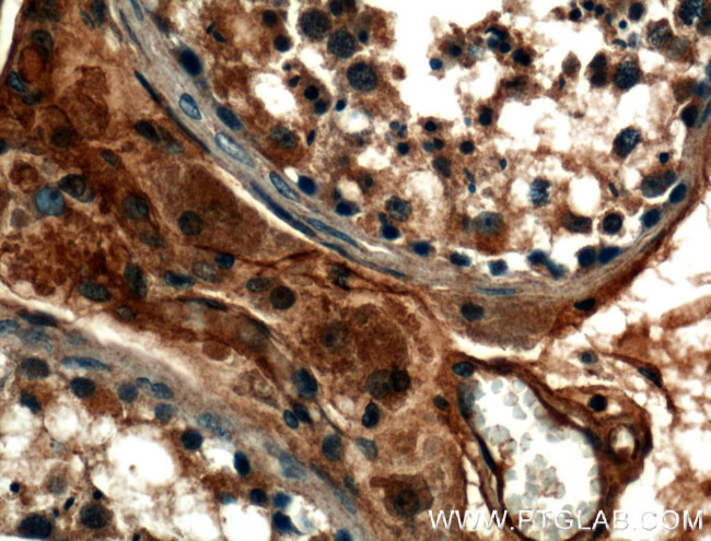 TMEM102 Antibody in Immunohistochemistry (Paraffin) (IHC (P))