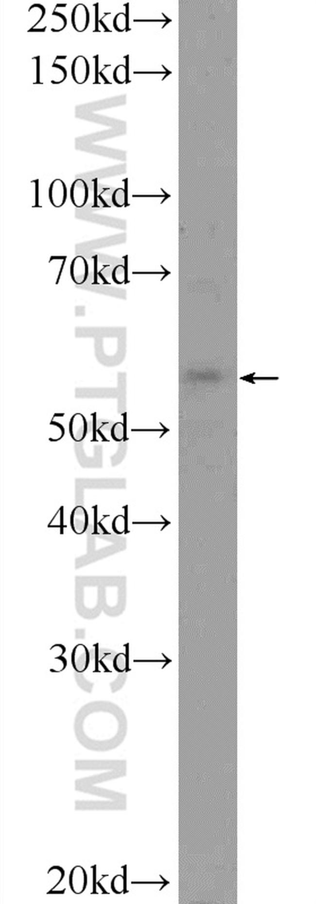 TMEM102 Antibody in Western Blot (WB)