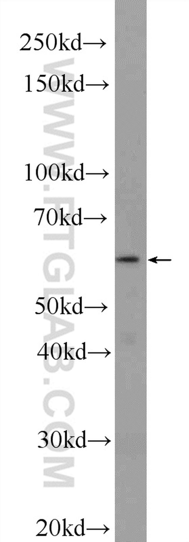 TMEM102 Antibody in Western Blot (WB)