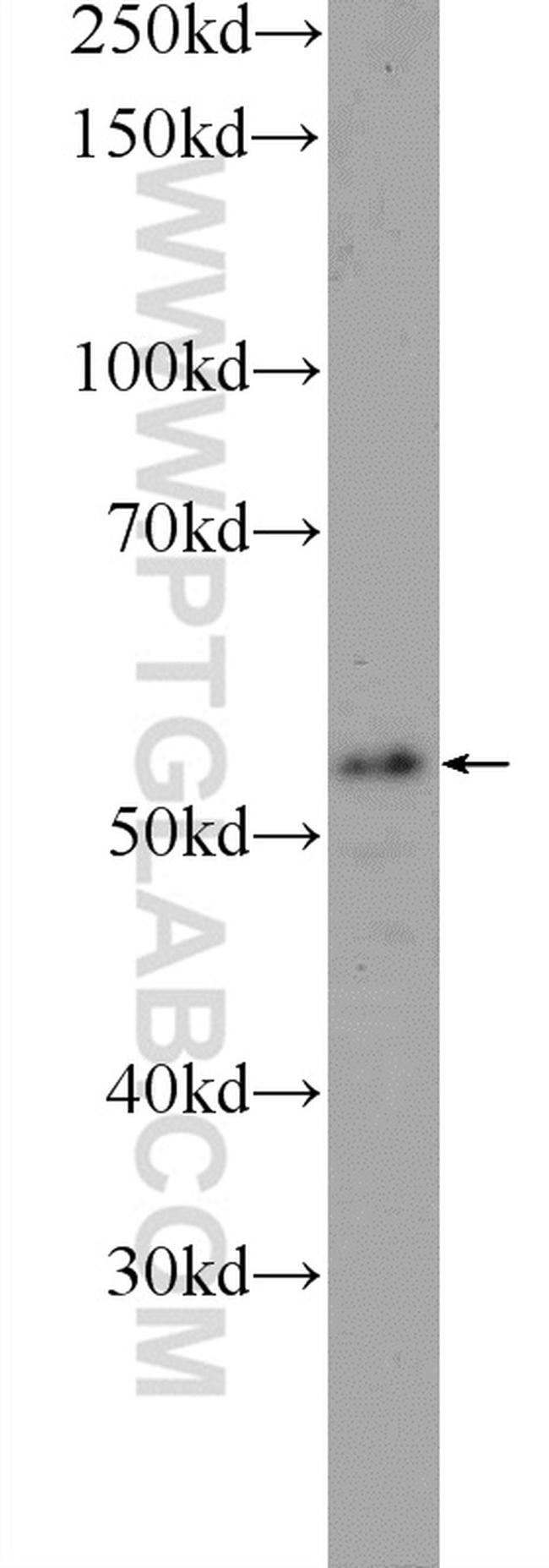 TMEM102 Antibody in Western Blot (WB)