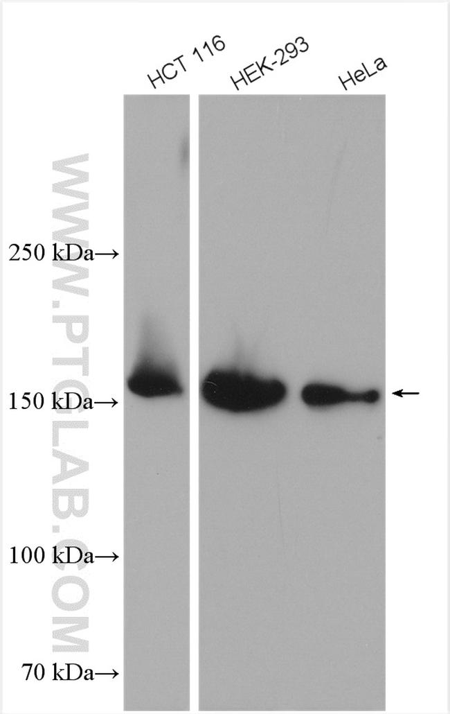 PDZD8 Antibody in Western Blot (WB)