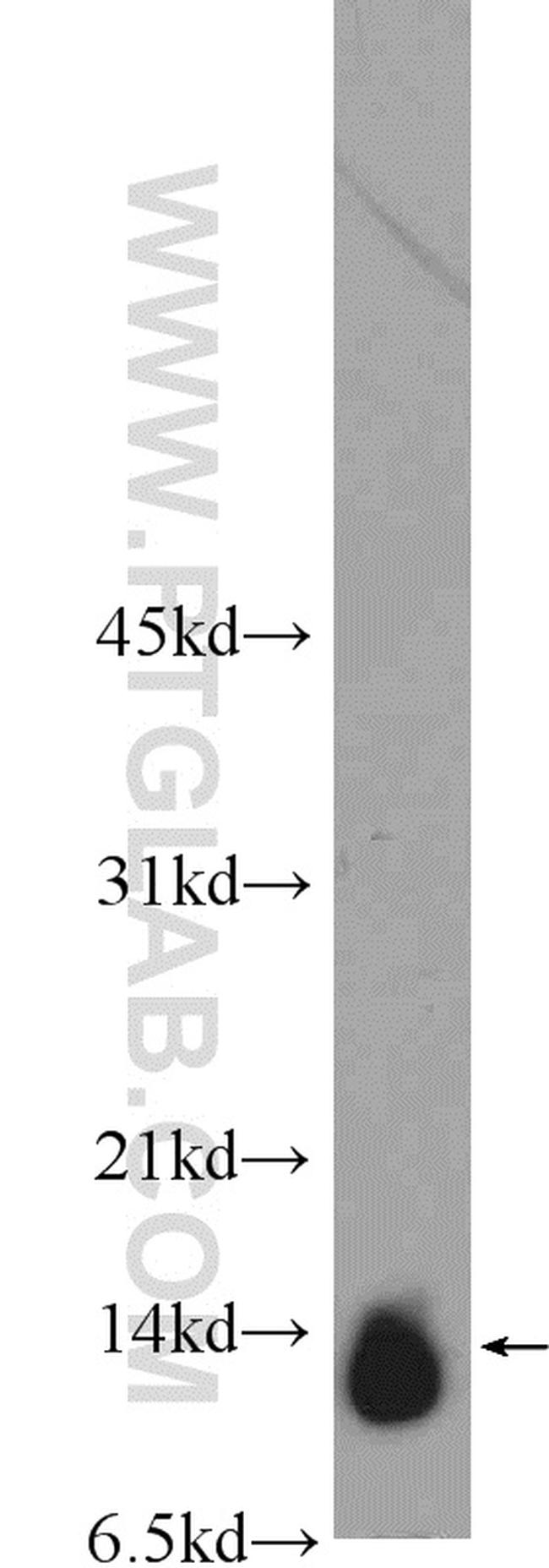 C19orf70 Antibody in Western Blot (WB)