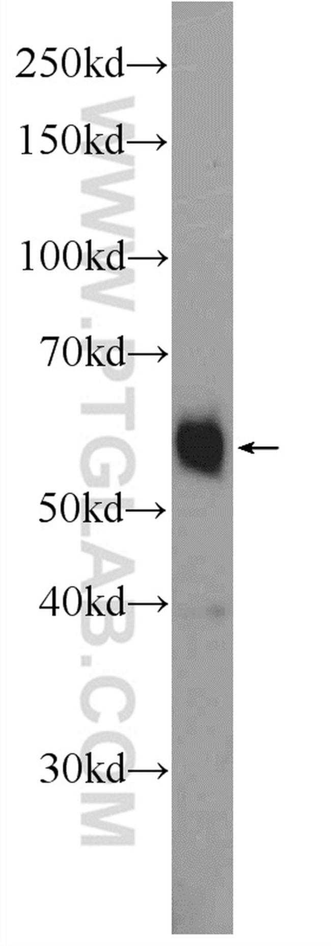 ZNF134 Antibody in Western Blot (WB)