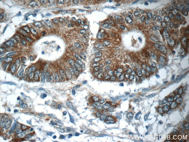 NPB Antibody in Immunohistochemistry (Paraffin) (IHC (P))