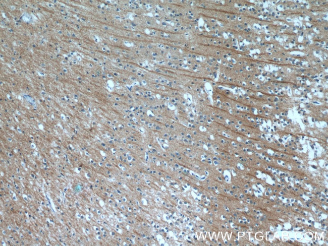 NPB Antibody in Immunohistochemistry (Paraffin) (IHC (P))