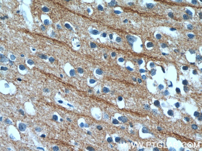 NPB Antibody in Immunohistochemistry (Paraffin) (IHC (P))