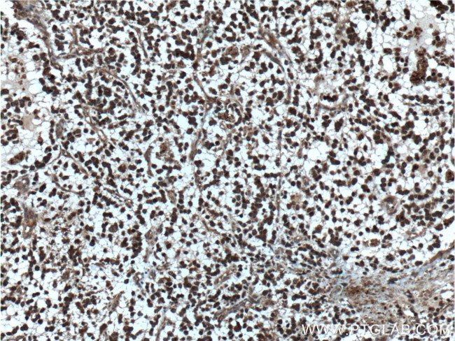 beta Amyloid (C-Terminal) Antibody in Immunohistochemistry (Paraffin) (IHC (P))