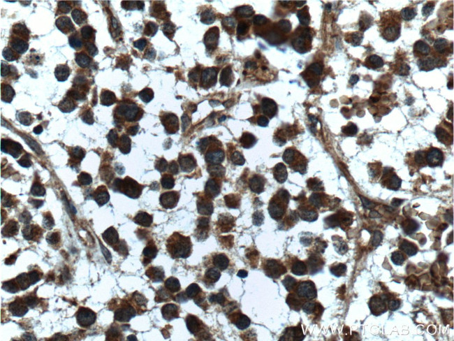 beta Amyloid (C-Terminal) Antibody in Immunohistochemistry (Paraffin) (IHC (P))