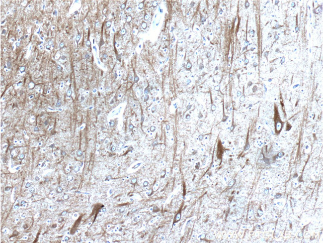 beta Amyloid (C-Terminal) Antibody in Immunohistochemistry (Paraffin) (IHC (P))