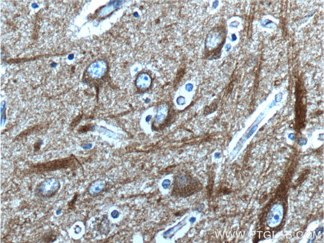 beta Amyloid (C-Terminal) Antibody in Immunohistochemistry (Paraffin) (IHC (P))