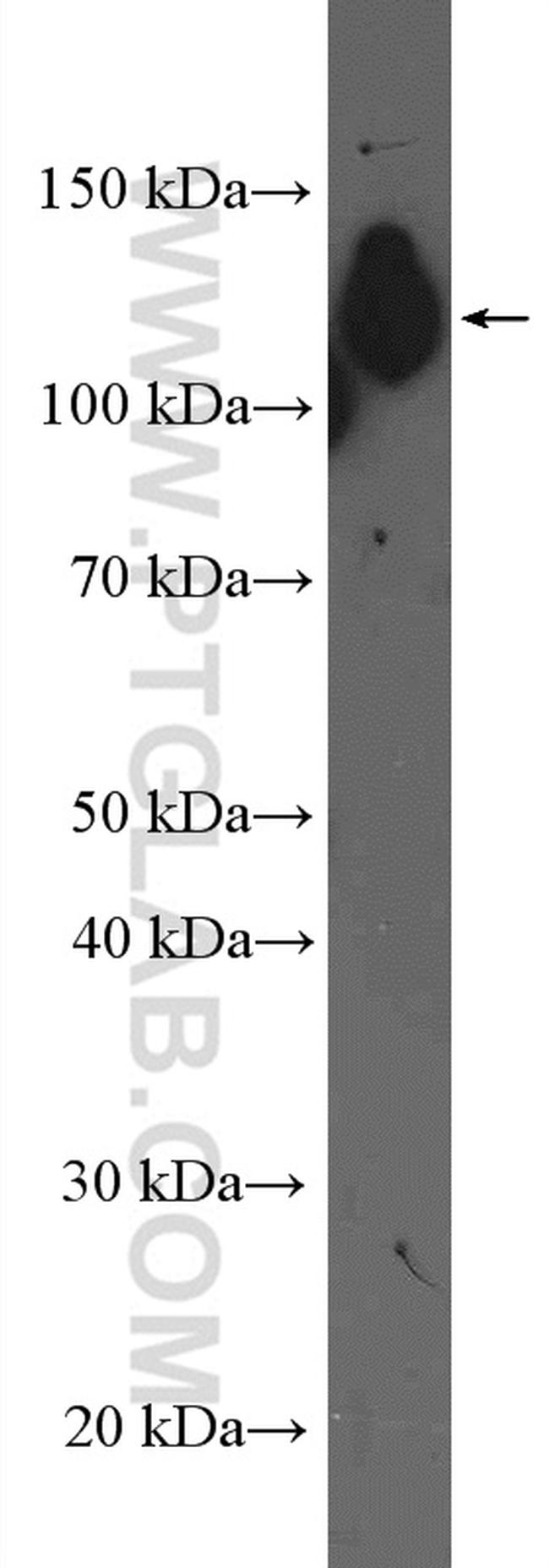 beta Amyloid (C-Terminal) Antibody in Western Blot (WB)