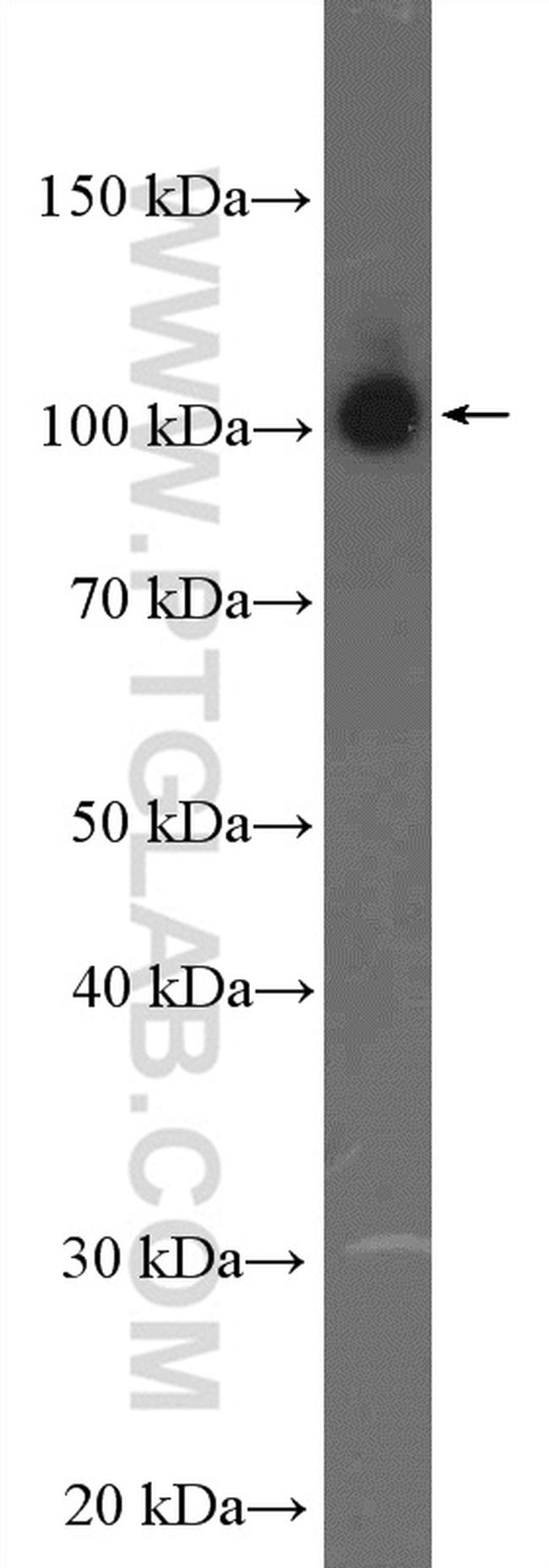 beta Amyloid (C-Terminal) Antibody in Western Blot (WB)