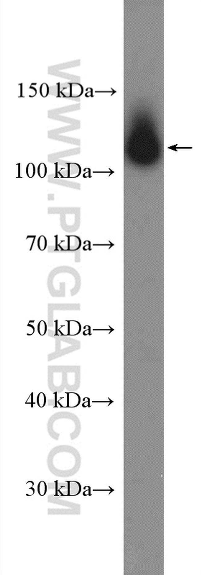 beta Amyloid (C-Terminal) Antibody in Western Blot (WB)