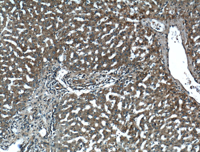 DLL3 Antibody in Immunohistochemistry (Paraffin) (IHC (P))