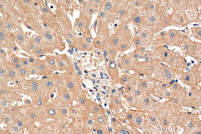 DLL3 Antibody in Immunohistochemistry (Paraffin) (IHC (P))