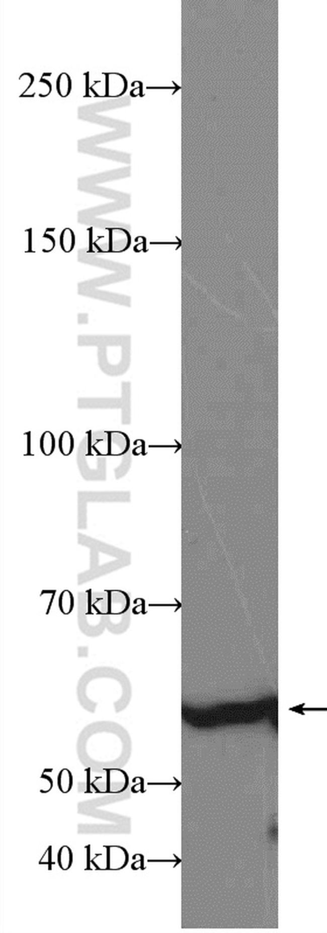 DLL3 Antibody in Western Blot (WB)