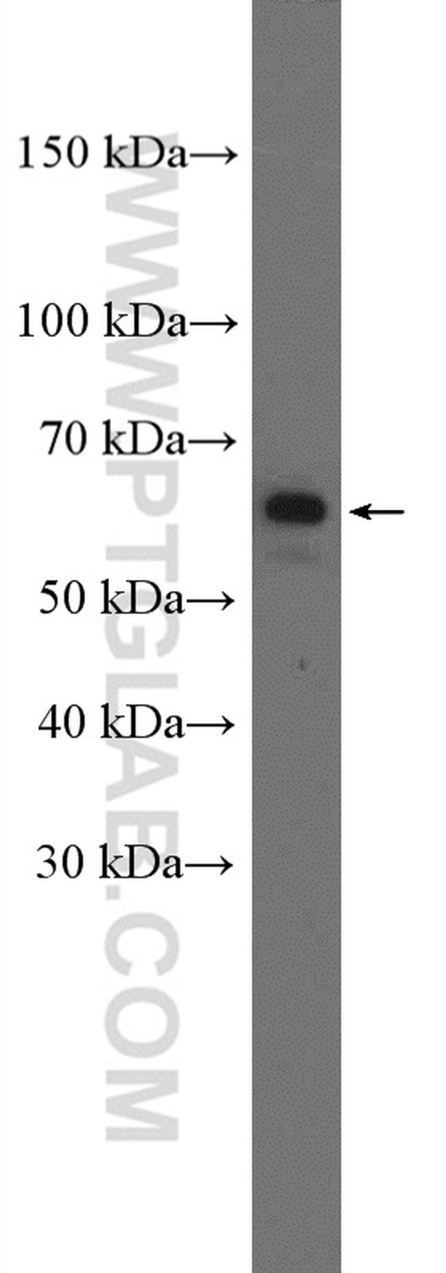 YTHDF3 Antibody in Western Blot (WB)