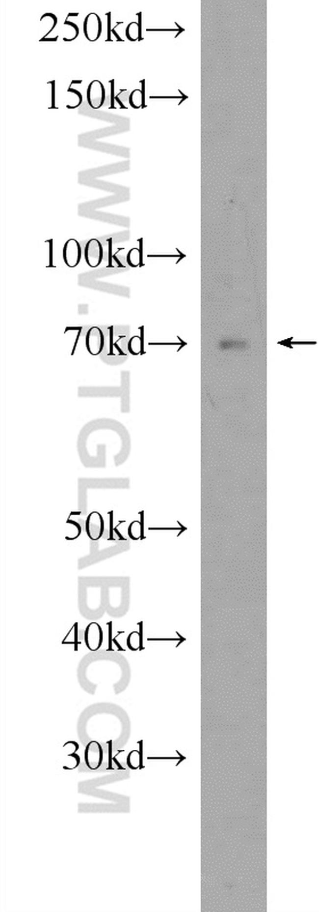 YTHDF3 Antibody in Western Blot (WB)