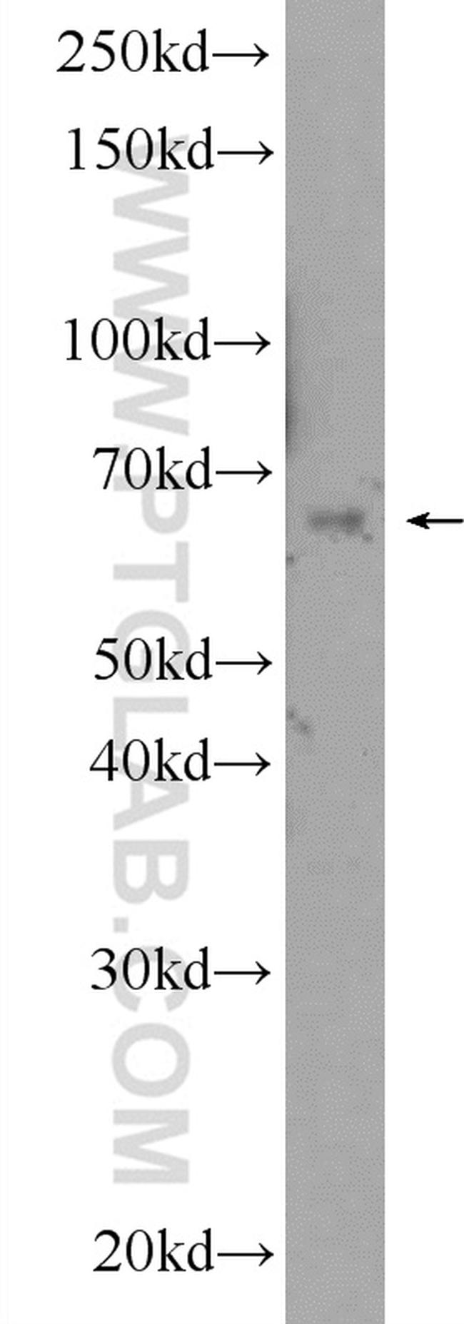 YTHDF3 Antibody in Western Blot (WB)