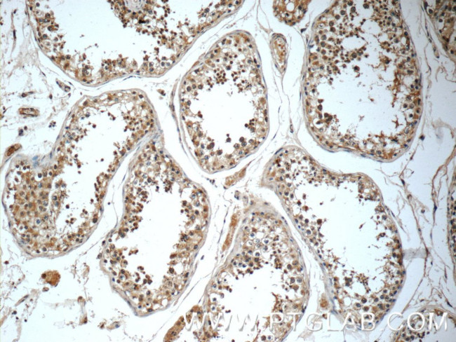 WDR92 Antibody in Immunohistochemistry (Paraffin) (IHC (P))