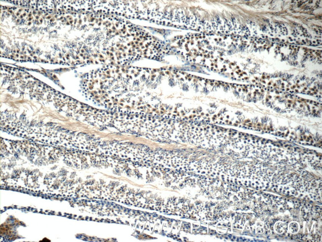 WDR92 Antibody in Immunohistochemistry (Paraffin) (IHC (P))