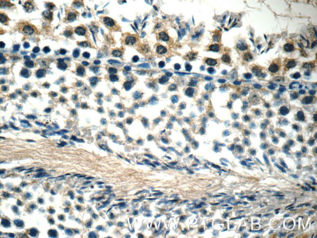 WDR92 Antibody in Immunohistochemistry (Paraffin) (IHC (P))