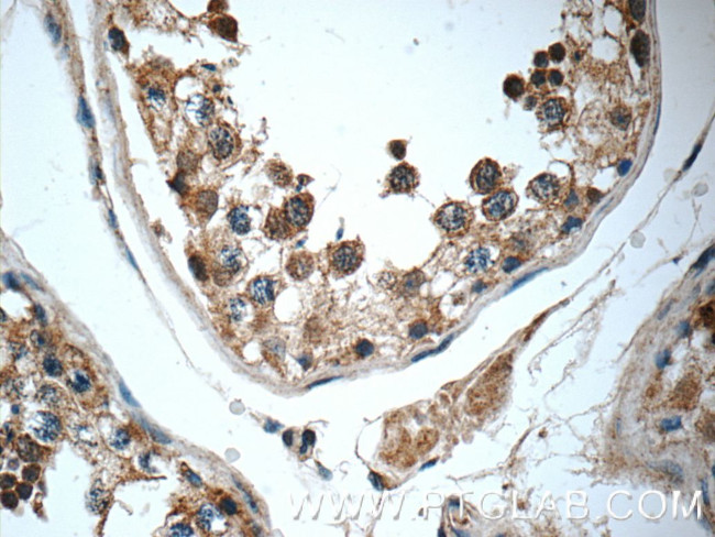 WDR92 Antibody in Immunohistochemistry (Paraffin) (IHC (P))