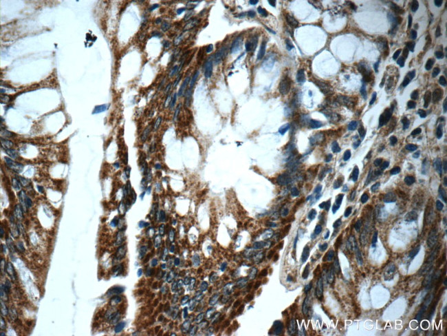 WDR92 Antibody in Immunohistochemistry (Paraffin) (IHC (P))