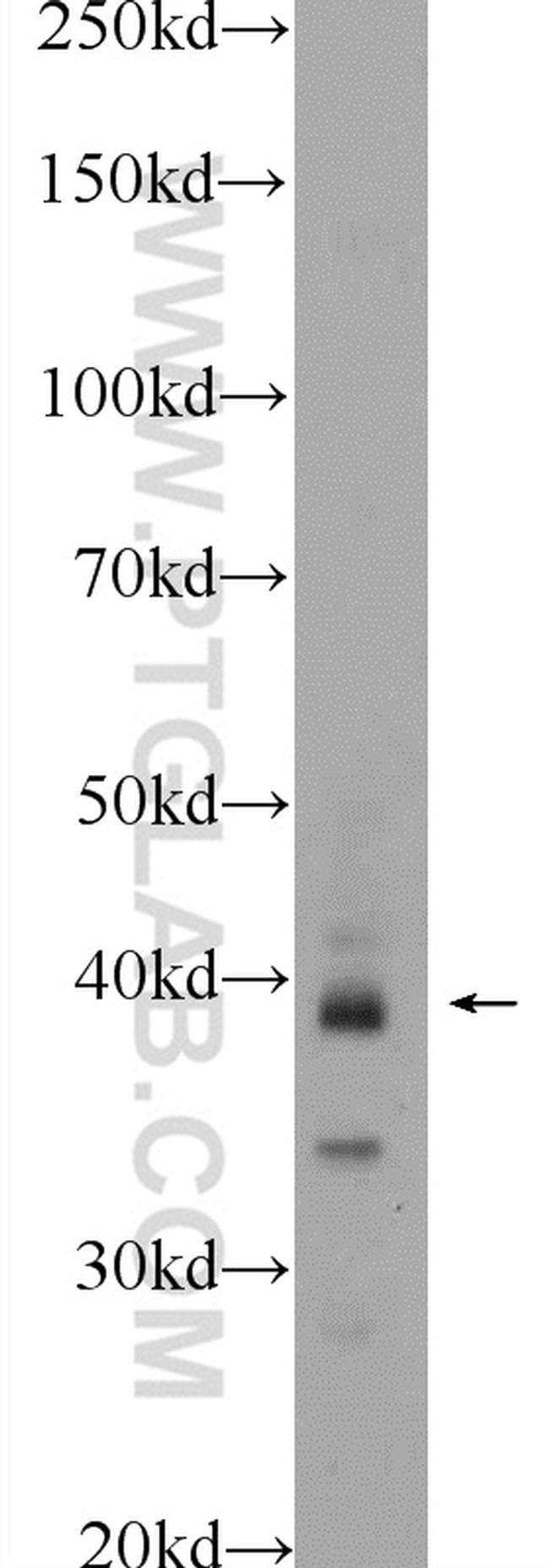 WDR92 Antibody in Western Blot (WB)