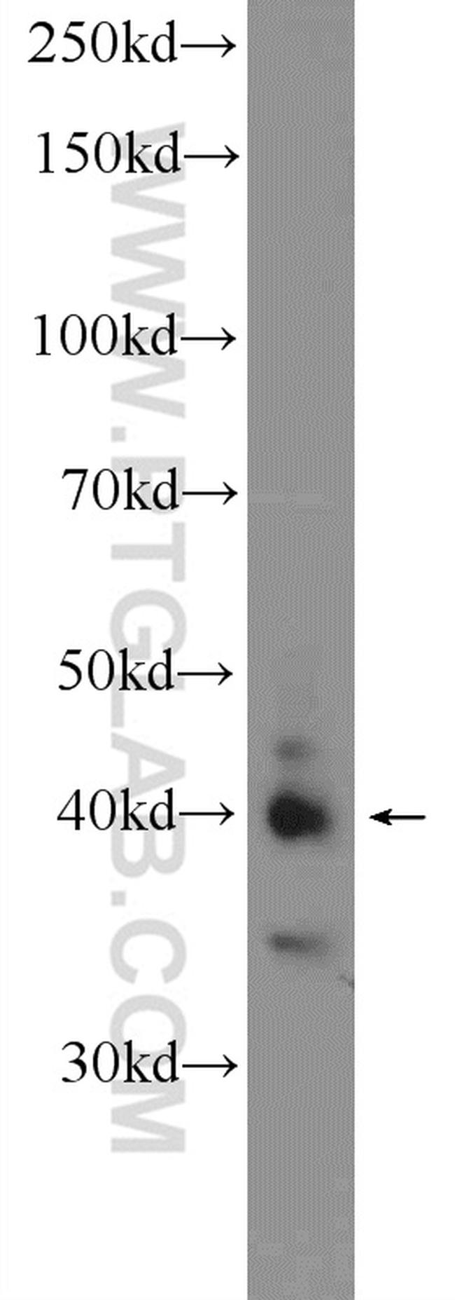 WDR92 Antibody in Western Blot (WB)