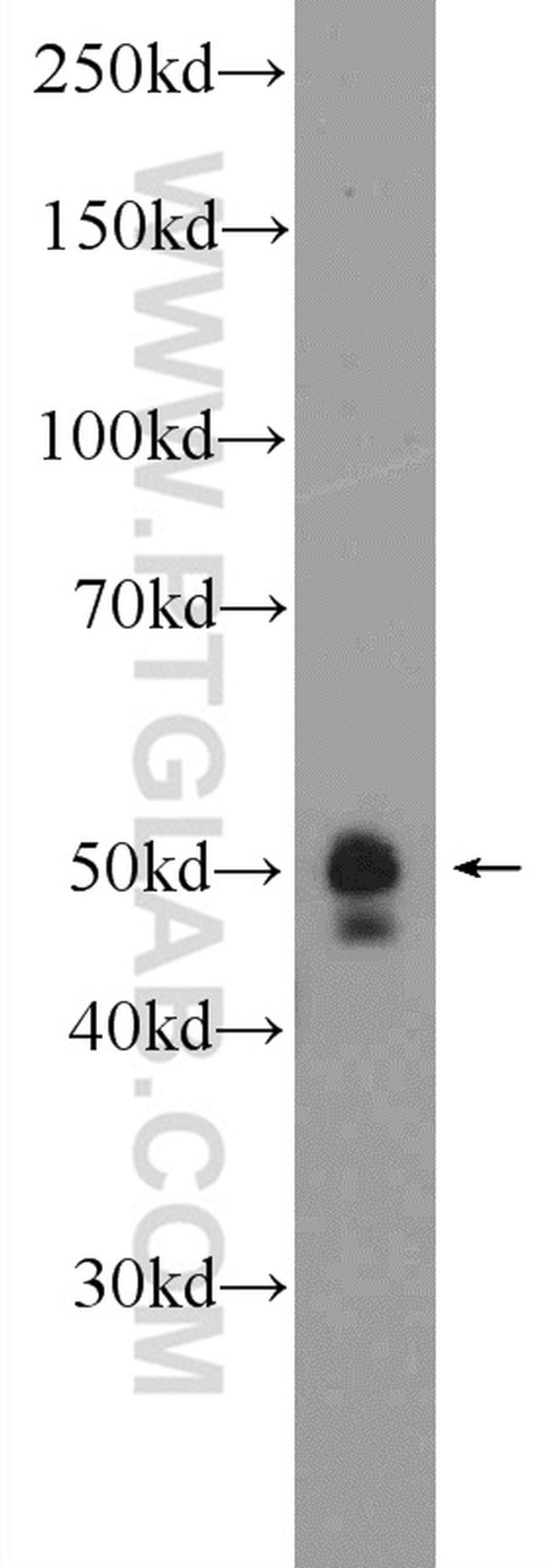 C1orf156 Antibody in Western Blot (WB)