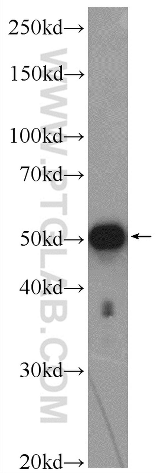 ZNF689 Antibody in Western Blot (WB)