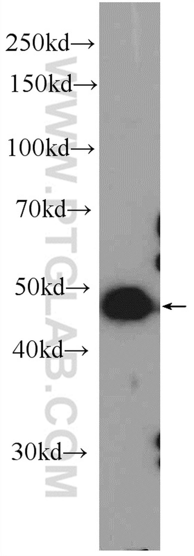 ZNF689 Antibody in Western Blot (WB)