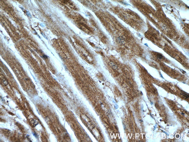 KBTBD10 Antibody in Immunohistochemistry (Paraffin) (IHC (P))