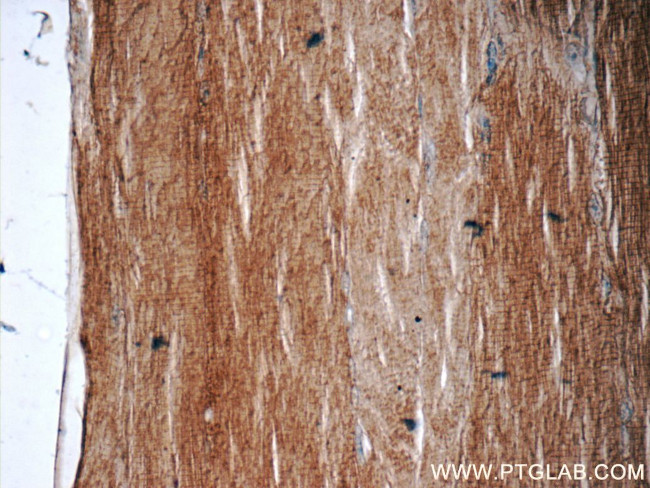 KBTBD10 Antibody in Immunohistochemistry (Paraffin) (IHC (P))