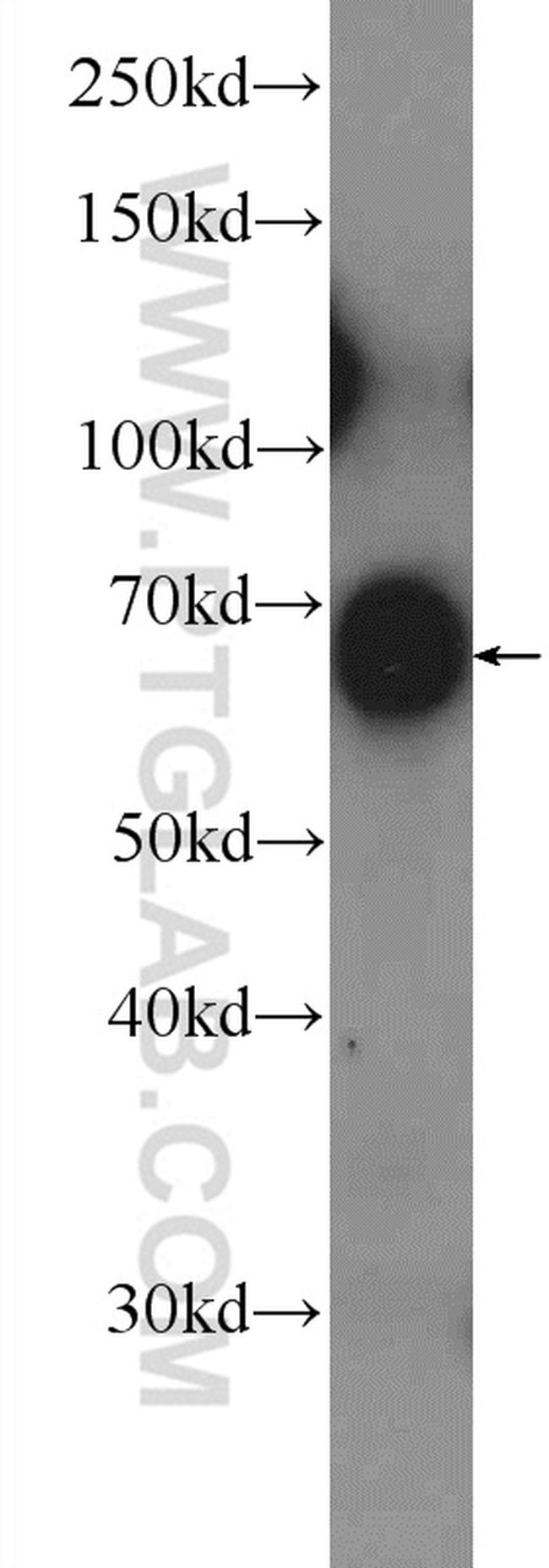 KBTBD10 Antibody in Western Blot (WB)