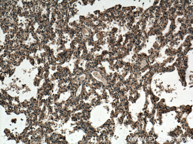 TMEM100 Antibody in Immunohistochemistry (Paraffin) (IHC (P))