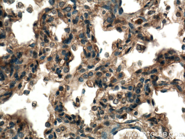 TMEM100 Antibody in Immunohistochemistry (Paraffin) (IHC (P))