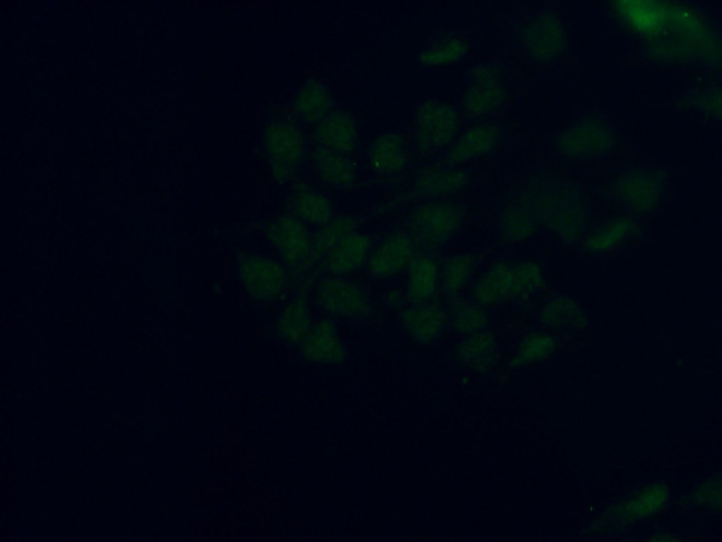 SMCHD1 Antibody in Immunocytochemistry (ICC/IF)